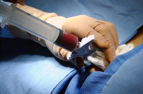Alla ricerca di donatori di midollo osseo: venerdì l’incontro all’UPO