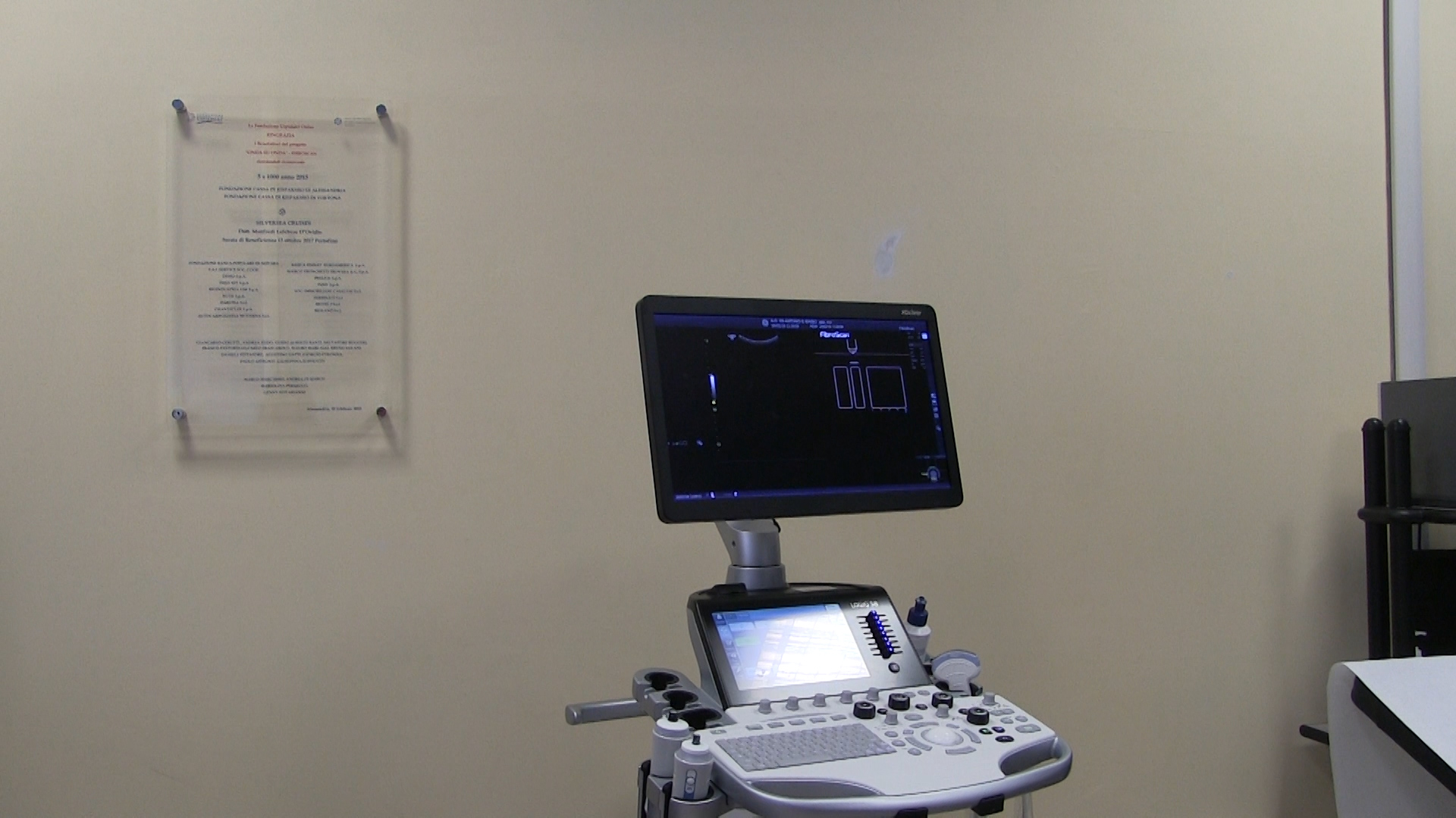 All’Ospedale di Alessandria il primo eco-fibroscan per le malattie epatiche
