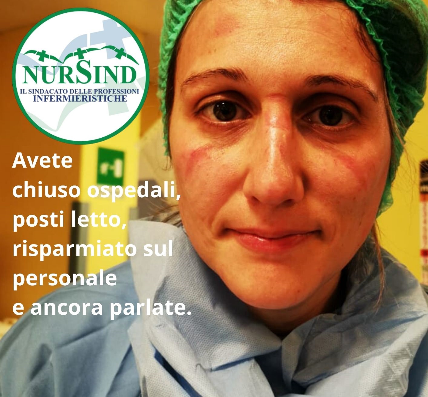 Coronavirus: NurSind replica a Unità di Crisi: “L’unico diritto che avete è chiedere scusa”