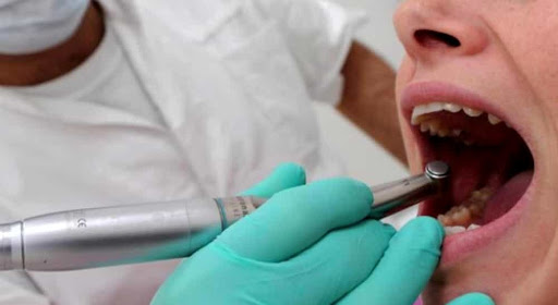 Decine di cittadini chiedono i danni a Dentix