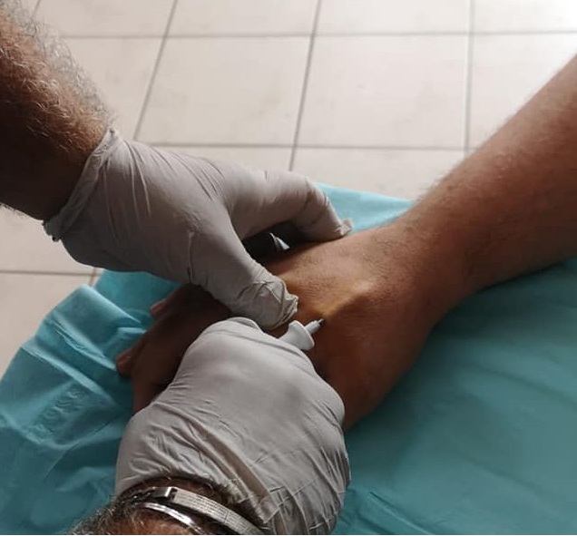 Un microbiglietto da visita sempre “a portata di mano”: parla un alessandrino col chip sottopelle