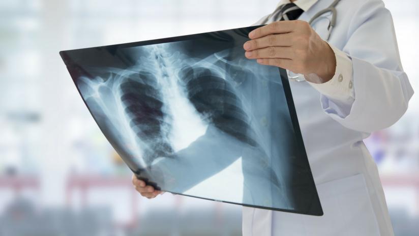 Con Zerocoda visite radiologiche al torace ed elettrocardiogrammi più facili da prenotare