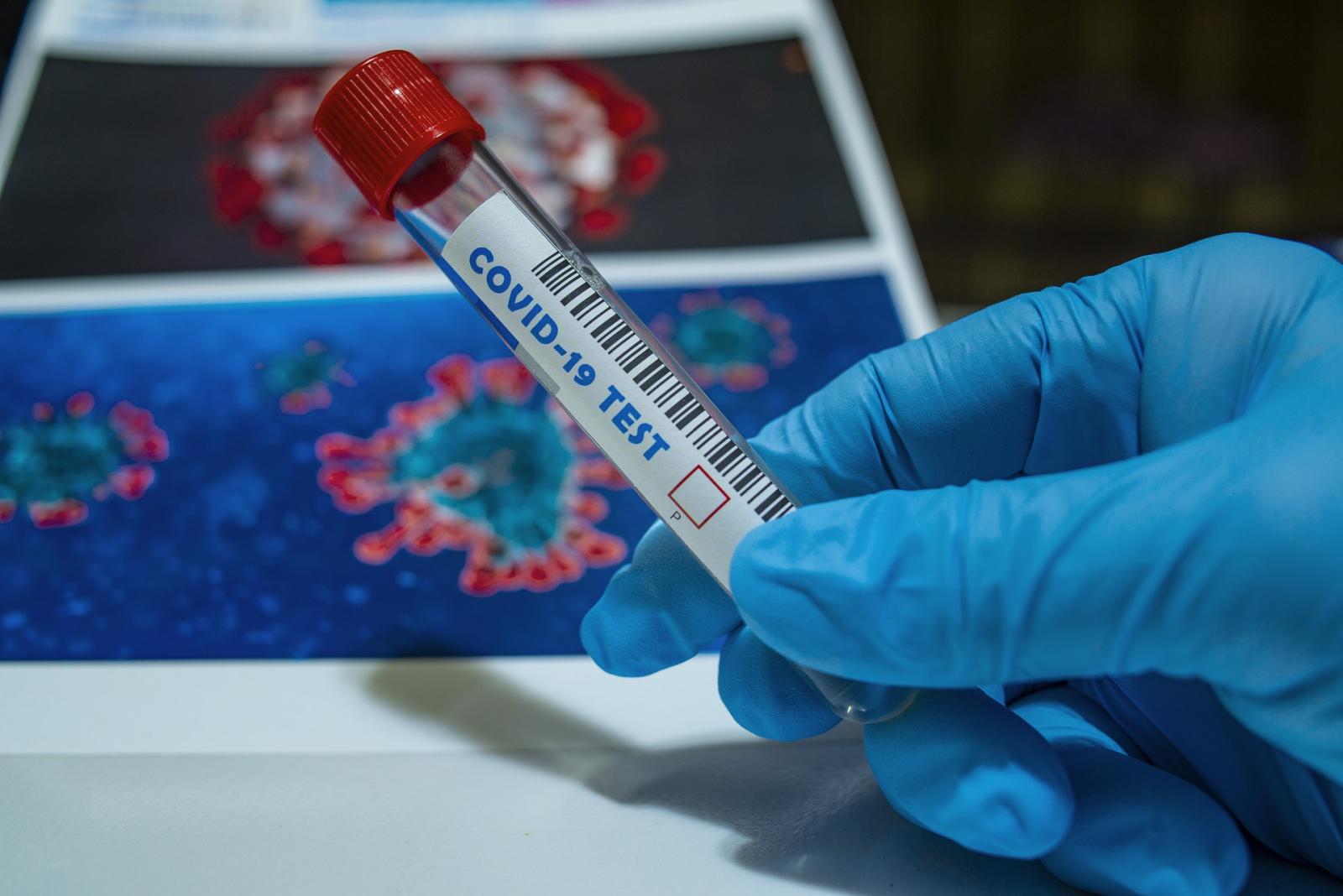 Bollettino coronavirus: in Piemonte altri 7652 nuovi contagi e 17 morti