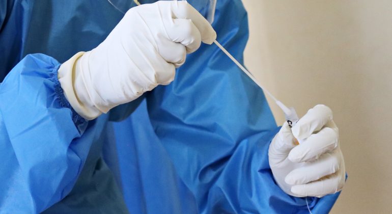 Bollettino coronavirus: 204 nuovi positivi e 5 decessi in Piemonte