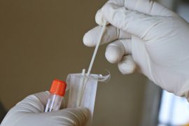 Bollettino coronavirus: in Piemonte 10.979 nuovi casi e 14 decessi