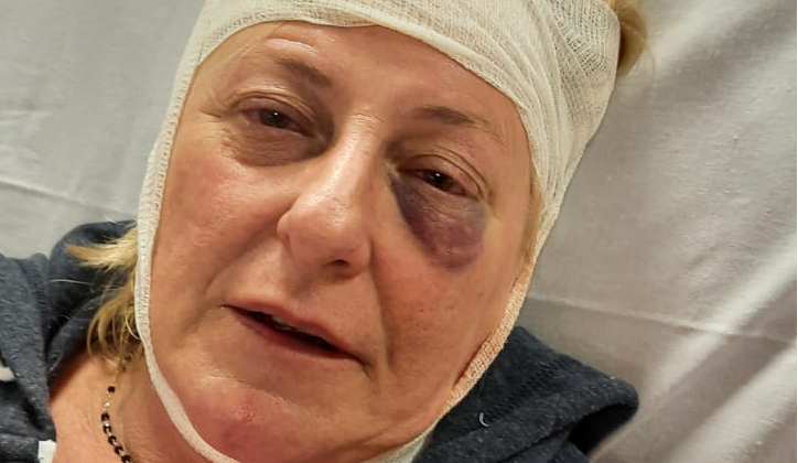 Aveva aggredito e offeso con insulti omofobi una vicina. Per l’uomo scatta il divieto di dimora ad Alessandria