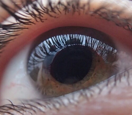 Settimana glaucoma: martedì visite gratuite a Valenza