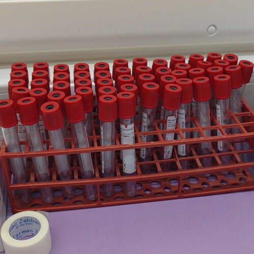 Pfas, Ordine dei Medici “preoccupato” per Spinetta e la Fraschetta: “Correlazione con danni alla salute”