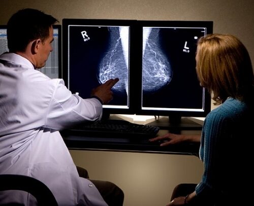 Prevenzione Serena, nel 2025 aumentano gli esami: cresce l’adesione agli screening gratuiti in Piemonte