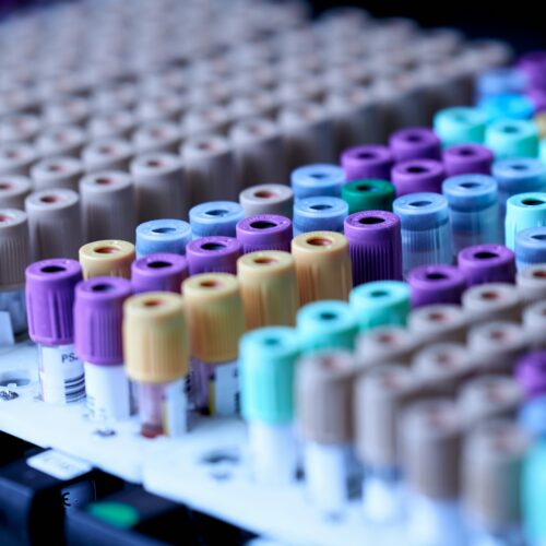 Pfas: studio università di Pavia e Pisa svela la doppia interferenza sulla funzione tiroidea e il neurosviluppo